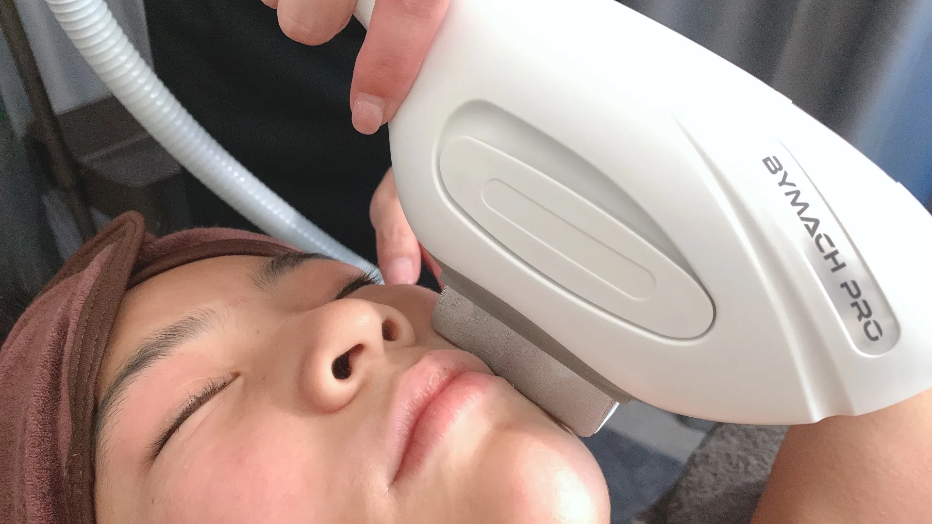 レディース顔脱毛