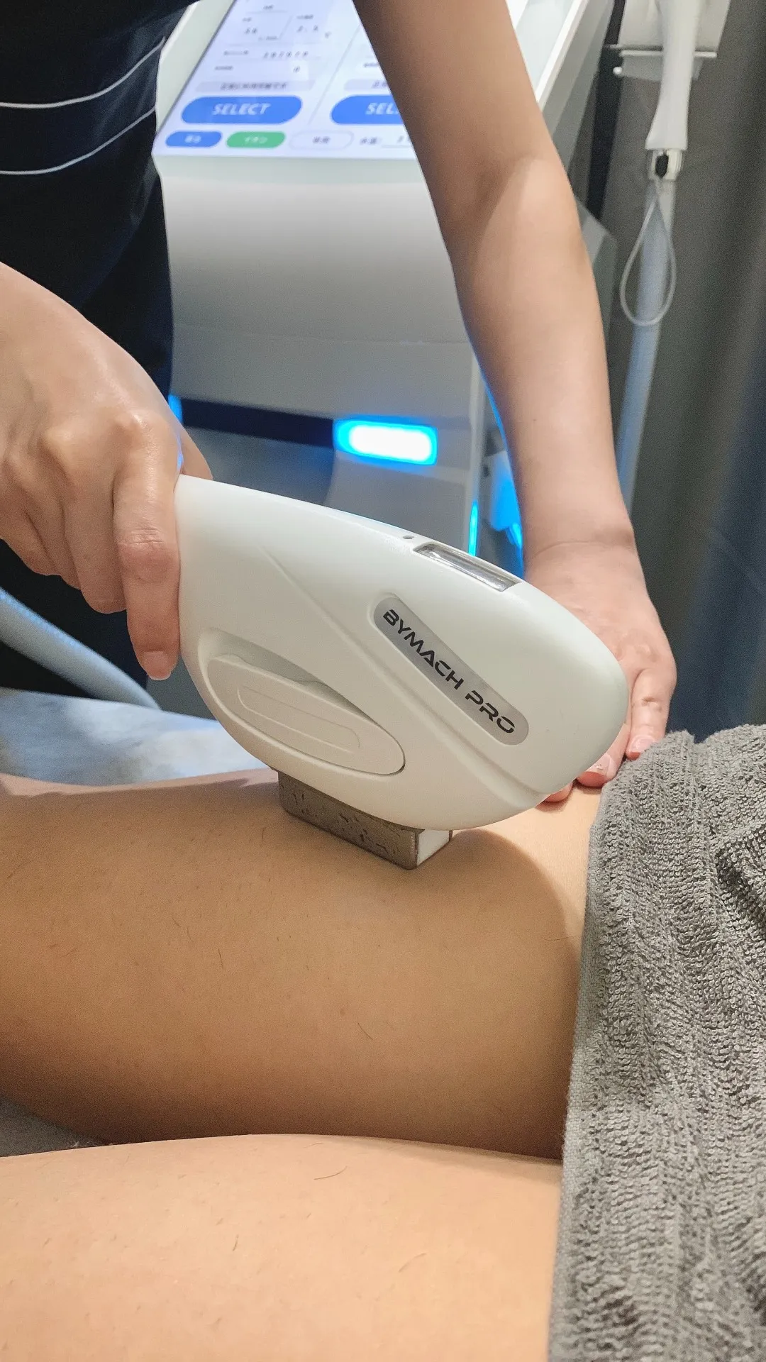 メンズ全身脱毛